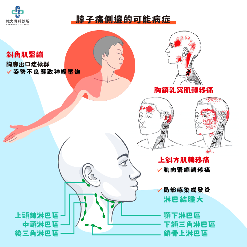 脖子痛側邊的可能疾病