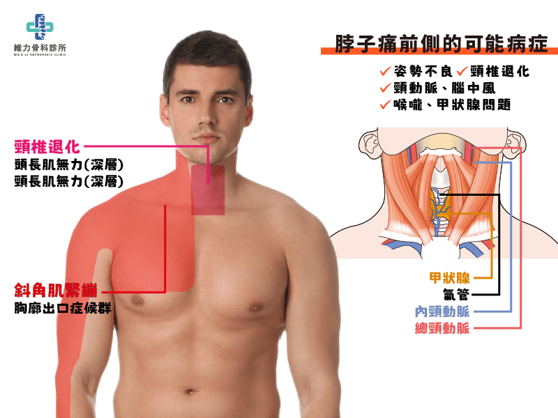 脖子痛前側