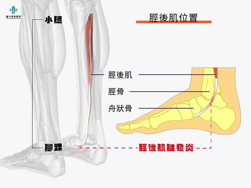 脛後肌位置