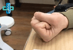 術前-ok.gif 板機指自我檢測