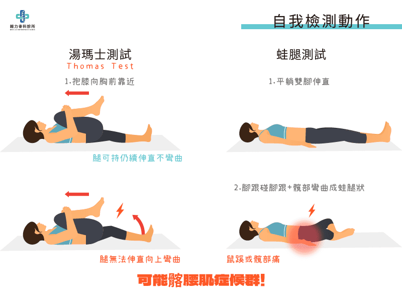 髂腰肌自我檢測動作