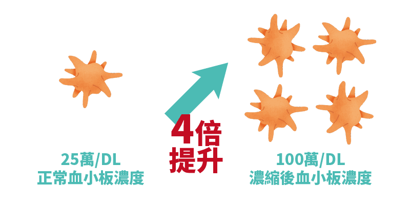 06增生治療_1.png 高濃度血小板血漿