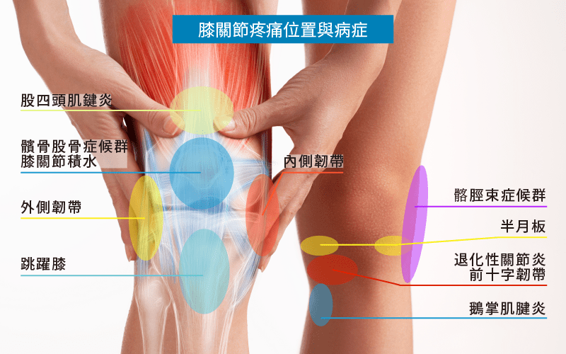 膝關節疼痛位置