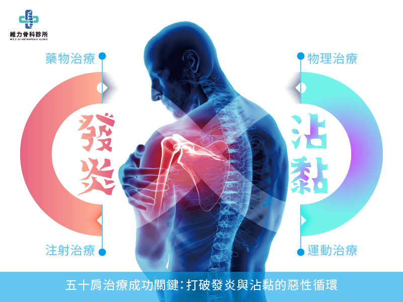 五十肩治療成功關鍵