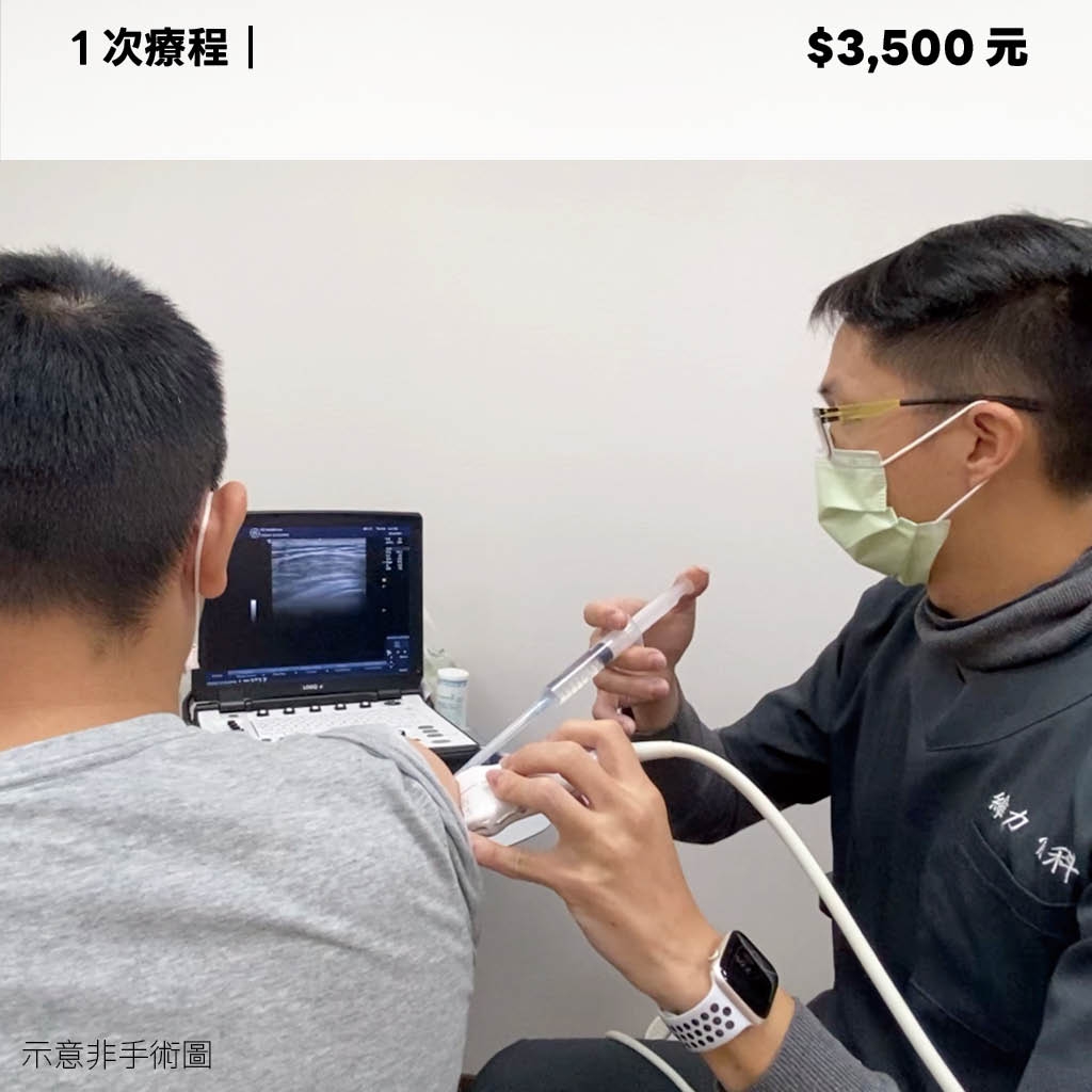 肩關節擴張術